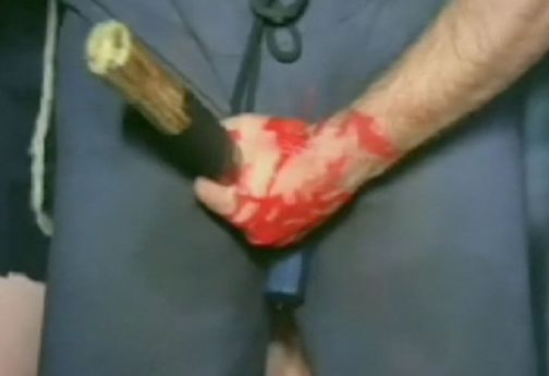 The girls took the "let's bury the hatchet" expression too far.