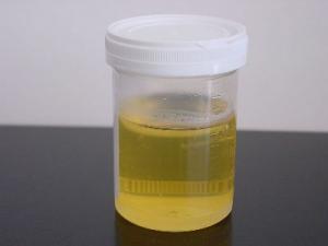 800px-Urine_sample